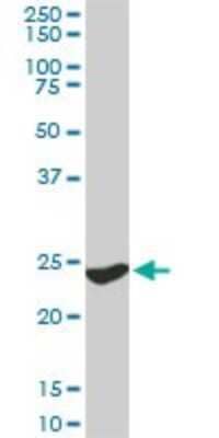 Western Blot: 14-3-3 gamma Antibody (6A10) [H00007532-M02] - YWHAG monoclonal antibody (M02), clone 6A10. Analysis of YWHAG expression in PC-12.