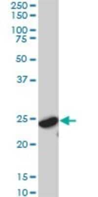 Western Blot: 14-3-3 gamma Antibody (6A10) [H00007532-M02] - YWHAG monoclonal antibody (M02), clone 6A10. Analysis of YWHAG expression in IMR-32.