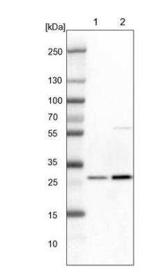 Western Blot: 14-3-3 gamma Antibody [NBP2-54679] - Lane 1: NIH-3T3 cell lysate (Mouse embryonic fibroblast cells) Lane 2: NBT-II cell lysate (Rat Wistar bladder tumour cells)