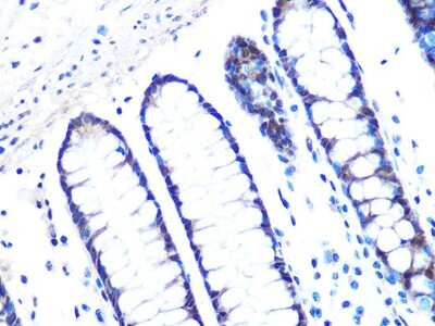 Immunohistochemistry-Paraffin: 14-3-3 sigma/Stratifin Antibody (8C8A9) [NBP3-16395] - Immunohistochemistry of paraffin-embedded human colon using 14-3-3 sigma/Stratifin Rabbit mAb (NBP3-16395) at dilution of 1:100 (40x lens).Perform microwave antigen retrieval with 10 mM PBS buffer pH 7.2 before commencing with IHC staining protocol.