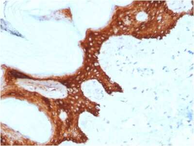 Immunohistochemistry-Paraffin: 14-3-3 sigma/Stratifin Antibody (CPTC-SFN-2) [NBP3-07326] - Formalin-fixed, paraffin-embedded human Skin stained with 14-3-3 sigma/Stratifin Mouse Monoclonal Antibody (CPTC-SFN-2).