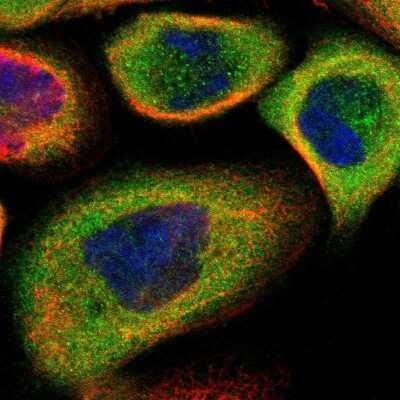 Immunocytochemistry/Immunofluorescence: 14-3-3 sigma/Stratifin Antibody [NBP1-80610] - Staining of human cell line A-431 shows localization to cytosol. Antibody staining is shown in green.