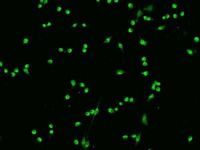 Immunocytochemistry/Immunofluorescence: 14-3-3 sigma/Stratifin Antibody [NBP2-98309] - Immunofluorescence staining of 14-3-3 sigma/Stratifin in Raw264.7 cells. Cells were fixed with 4% PFA, permeabilzed with 0.1% Triton X-100 in PBS, blocked with 10% serum, and incubated with rabbit anti-Mouse 14-3-3 sigma/Stratifin polyclonal antibody (dilution ratio 1:200) at 4C overnight. Then cells were stained with the Alexa Fluor(R)488-conjugated Goat Anti-rabbit IgG Secondary antibody (green). Positive staining was localized to Cytoplasm.