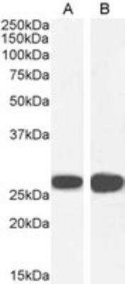 Western Blot: 14-3-3 sigma/Stratifin Antibody [NB100-2465] - Staining of A431 (A) and U2OS (B) cell lysate (35 ug protein in RIPA buffer). Antibody at 0.03 ug/mL. Detected by chemiluminescence.