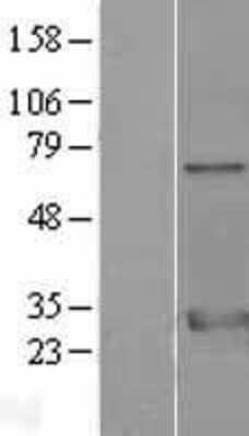 Western Blot: 14-3-3 zeta/beta Overexpression Lysate (Adult Normal) [NBP2-05475] Left-Empty vector transfected control cell lysate (HEK293 cell lysate); Right -Over-expression Lysate for 14-3-3 zeta/beta.