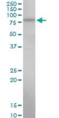 Western Blot: 15-Lipoxygenase 1 Antibody (1A11) [H00000246-M07] - Analysis of ALOX15 expression in HeLa(Cat # L013V1).