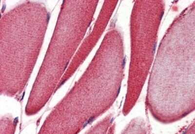 Immunohistochemistry-Paraffin: 15-Lipoxygenase 1 Antibody [NBP1-06976] - (2ug/ml) staining of paraffin embedded Human Skeletal Muscle. Steamed antigen retrieval with citrate buffer pH 6, AP-staining.