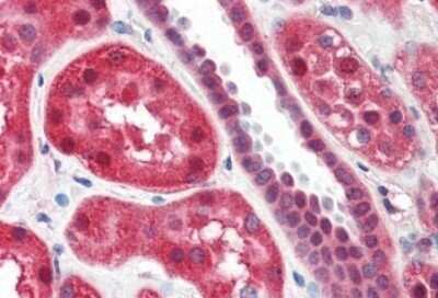 Immunohistochemistry-Paraffin: 15-Lipoxygenase 1 Antibody [NBP1-06976] - (2ug/ml) staining of paraffin embedded Human Kidney. Steamed antigen retrieval with citrate buffer pH 6, AP-staining.