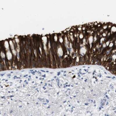 Immunohistochemistry-Paraffin: 15-Lipoxygenase 1 Antibody [NBP1-90336] - Staining of human bronchus shows strong cytoplasmic positivity in respiratory epithelial cells.