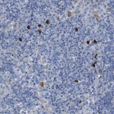 Immunohistochemistry-Paraffin: 15-Lipoxygenase 1 Antibody [NBP1-90336] - Staining of human lymph node shows strong cytoplasmic positivity ina small subset of non-germinal center cells.