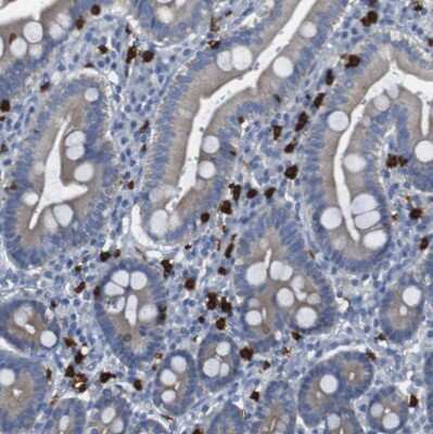 Immunohistochemistry-Paraffin: 15-Lipoxygenase 1 Antibody [NBP1-90336] - Staining of human duodenum shows strong cytoplasmic positivity in lymphoid cells.