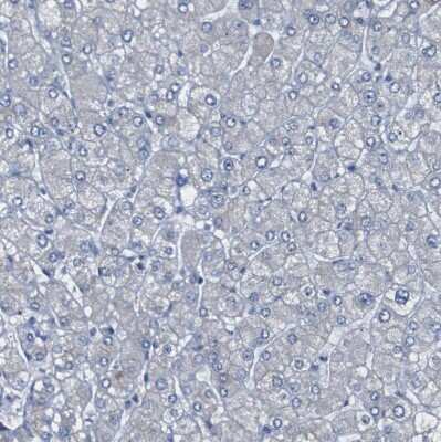 Immunohistochemistry-Paraffin: 15-Lipoxygenase 1 Antibody [NBP1-90336] - Staining of human liver shows no positivity in hepatocytes as expected.