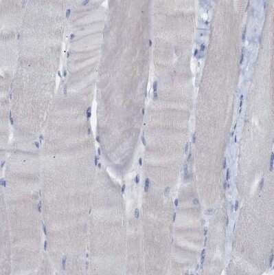 Immunohistochemistry-Paraffin: 15-Lipoxygenase 1 Antibody [NBP1-90336] - Staining of human skeletal muscle shows no positivity in myocytes as expected.