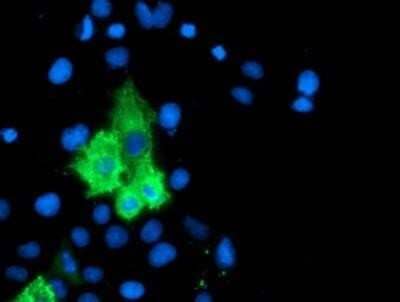 Immunocytochemistry/Immunofluorescence: 15-Lipoxygenase 1 Antibody (OTI3G8) - Azide and BSA Free [NBP2-70169] - Staining in COS7 cells