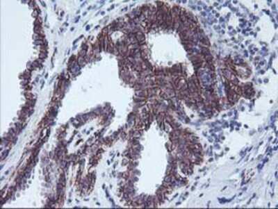 Immunohistochemistry: 15-Lipoxygenase 1 Antibody (OTI3G8) - Azide and BSA Free [NBP2-70169] - Staining of paraffin-embedded Human breast tissue using anti-15 Lipoxygenase 1 mouse monoclonal antibody.