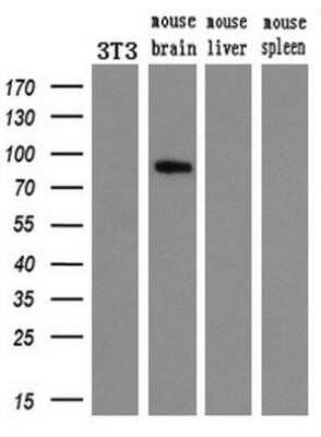 Western Blot: 15-Lipoxygenase 1 Antibody (OTI3G8) - Azide and BSA Free [NBP2-70169] - Analysis of extracts (10ug) from a mouse cell line and 3 different mouse tissues by using anti-ALOX15 monoclonal antibody.(1:200)