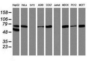 Western Blot: 15-Lipoxygenase 1 Antibody (OTI3G8) - Azide and BSA Free [NBP2-70169] - Analysis of extracts (35ug) from 9 different cell lines by using anti-15 Lipoxygenase 1 monoclonal antibody.