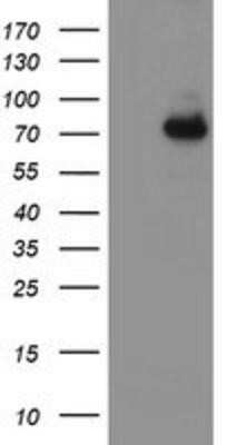 Western Blot: 15-Lipoxygenase 1 Antibody (OTI3G8) - Azide and BSA Free [NBP2-70169] - HEK293T cells were transfected with the pCMV6-ENTRY control (Left lane) or pCMV6-ENTRY 15 Lipoxygenase 1 (Right lane) cDNA for 48 hrs and lysed. Equivalent amounts of cell lysates (5 ug per lane) were separated by SDS-PAGE and immunoblotted with anti-15 L