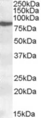 Western Blot: 15-Lipoxygenase 1 Antibody [NBP1-06976] - (0.2ug/ml) staining of nuclear HeLa lysate (35ug protein in RIPA buffer). Detected by chemiluminescence.