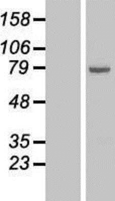 Western Blot: 15-Lipoxygenase 1 Overexpression Lysate (Native) [NBL1-07481] - Left-Empty vector transfected control cell lysate (HEK293 cell lysate); Right -15-Lipoxygenase 1 Overexpression Lysate (Native).