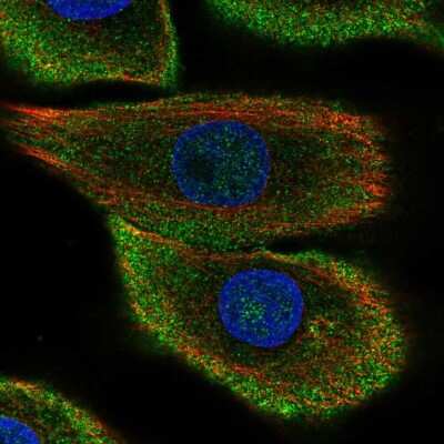 Immunocytochemistry/Immunofluorescence: 15-Lipoxygenase 2 Antibody [NBP2-58984] - Staining of human cell line hTCEpi shows localization to plasma membrane & cytosol. Antibody staining is shown in green.