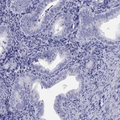 Immunohistochemistry-Paraffin: 15-Lipoxygenase 2 Antibody [NBP2-58984] - Staining of human endometrium shows low expression as expected.