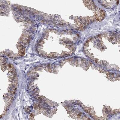 Immunohistochemistry-Paraffin: 15-Lipoxygenase 2 Antibody [NBP2-58984] - Staining of human prostate shows high expression.