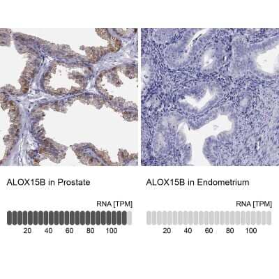 Immunohistochemistry-Paraffin: 15-Lipoxygenase 2 Antibody [NBP2-58984] - Staining in human prostate and endometrium tissues using anti-ALOX15B antibody. Corresponding ALOX15B RNA-seq data are presented for the same tissues.