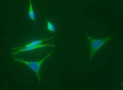 Immunocytochemistry/Immunofluorescence: 15-PGDH/HPGD Antibody (016) [NBP2-89839] - Staining of Human HPGD in Hela cells. Cells were fixed with 4% PFA, permeabilzed with 1% Triton X-100 in PBS, blocked with 10% serum, and incubated with Rabbit anti-Human HPGD monoclonal antibody (1:60) at 37c 1 hour. Then cells were stained with the Alexa Fluor(R) 488-conjugated Goat Anti-rabbit IgG secondary antibody (green) and counterstained with DAPI (blue). Positive staining was localized to cytoplasm.