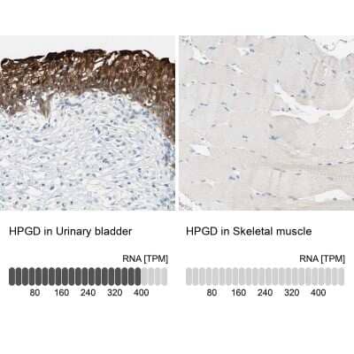 <b>Orthogonal Strategies Validation. </b>Immunohistochemistry-Paraffin: 15-PGDH/HPGD Antibody [NBP1-87061] - Analysis in human urinary bladder and skeletal muscle tissues. Corresponding HPGD RNA-seq data are presented for the same tissues.