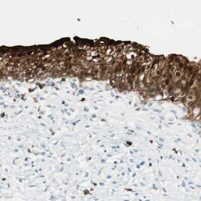 Immunohistochemistry-Paraffin: 15-PGDH/HPGD Antibody [NBP1-87062] - Staining of human urinary bladder shows high expression.