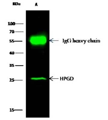 Immunoprecipitation: 15-PGDH/HPGD Antibody [NBP2-98291] - Mouse 15-PGDH/HPGD was immunoprecipitated using: Lane A: 0.5 mg Caco-2 Whole Cell Lysate. 2 ul anti-Mouse 15-PGDH/HPGD rabbit polyclonal antibody and 15 ul of 50 % Protein G agarose. Primary antibody: Anti-Mouse 15-PGDH/HPGD rabbit polyclonal antibody, at 1:200 dilution. Secondary antibody: Dylight 800-labeled antibody to rabbit IgG (H+L), at 1:5000 dilution. Developed using the Odyssey technique. Performed under reducing conditions. Predicted band size: 29 kDa. Observed band size: 29 kDa