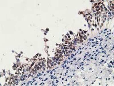 Immunohistochemistry: 15-PGDH/HPGD Antibody (OTI2C10) - Azide and BSA Free [NBP2-70933] - Staining of Human bladder tissue using anti-15-PGDH mouse monoclonal antibody.