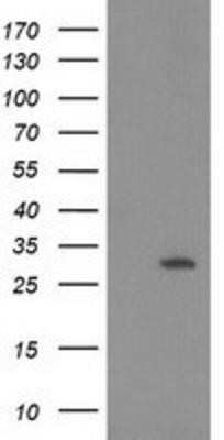 Western Blot: 15-PGDH/HPGD Antibody (OTI2C10) - Azide and BSA Free [NBP2-70933] - HEK293T cells were transfected with the pCMV6-ENTRY control (Left lane) or pCMV6-ENTRY 15-PGDH (Right lane) cDNA for 48 hrs and lysed. Equivalent amounts of cell lysates (5 ug per lane) were separated by SDS-PAGE and immunoblotted with anti-15-PGDH.