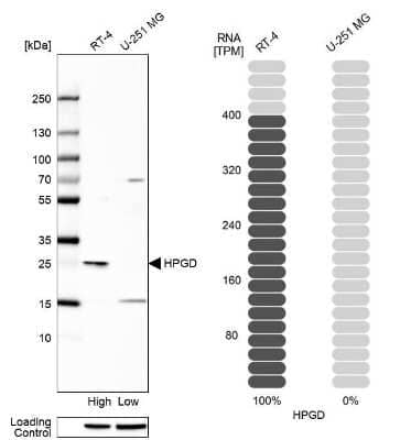 <b>Orthogonal Strategies Validation. </b>Western Blot: 15-PGDH/HPGD Antibody [NBP1-87062] - Analysis in human cell line RT-4 and human cell line U-251 MG.