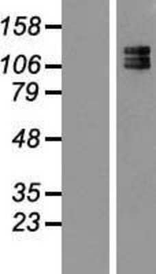 Western Blot: 160kDa Neurofilament Medium Overexpression Lysate (Adult Normal) [NBL1-13578] Left-Empty vector transfected control cell lysate (HEK293 cell lysate); Right -Over-expression Lysate for 160kDa Neurofilament Medium.