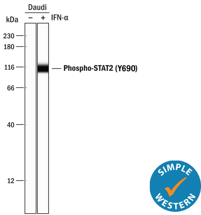<b>Biological Strategies Validation. </b>Simple Western lane view shows lysates of Daudi human Burkitt's lymphoma cell line untreated (-) or treated (+) with 500 U/mL Recombinant Human IFN-aA (11100-1) for 20 minutes, loaded at 0.2 mg/mL. A specific band was detected for Phospho-STAT2 (Y690) at approximately 111 kDa (as indicated) using 0.5 µg/mL of Rabbit Anti-Human Phospho-STAT2 (Y690) Monoclonal Antibody (Catalog # MAB2890). This experiment was conducted under reducing conditions and using the 12-230 kDa separation system.
