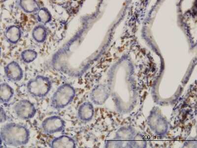 Immunohistochemistry-Paraffin: 17 beta-HSD1/HSD17B1 Antibody (2E5) [H00003292-M03] - Analysis of monoclonal antibody to HSD17B1 on formalin-fixed paraffin-embedded human small Intestine. Antibody concentration 3 ug/ml