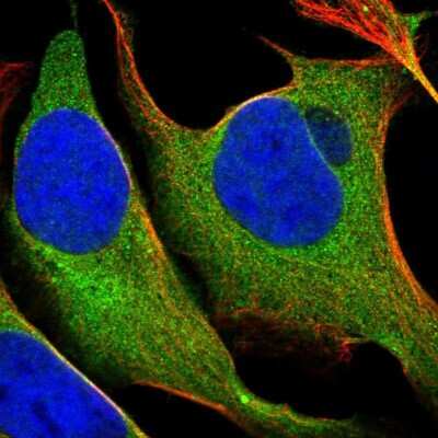 Immunocytochemistry/Immunofluorescence: 17 beta-HSD1/HSD17B1 Antibody [NBP1-84901] - Immunofluorescent staining of human cell line U-2 OS shows localization to cytosol.