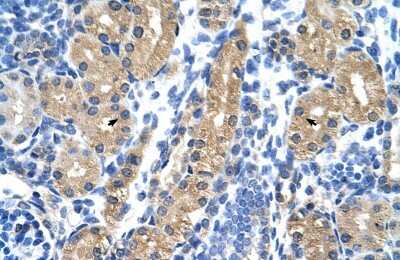 Immunohistochemistry-Paraffin: 17 beta-HSD1/HSD17B1 Antibody [NBP1-56295] - Human kidney Tissue, antibody concentration 4-8ug/ml. Cells with positive label: renal corpuscle cells (indicated with arrows) 400X magnification.