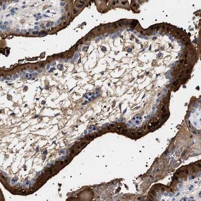 Immunohistochemistry-Paraffin: 17 beta-HSD1/HSD17B1 Antibody [NBP1-84901] - Staining of human placenta shows strong nuclear and cytoplasmic positivity in Syncytiotrophoblasts.