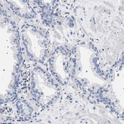 Immunohistochemistry-Paraffin: 17 beta-HSD1/HSD17B1 Antibody [NBP1-84901] - Staining of human prostate shows low expression as expected.