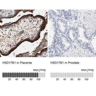 <b>Orthogonal Strategies Validation. </b>Immunohistochemistry-Paraffin: 17 beta-HSD1/HSD17B1 Antibody [NBP1-84901] - Staining in human placenta and prostate tissues using anti-HSD17B1 antibody. Corresponding HSD17B1 RNA-seq data are presented for the same tissues.