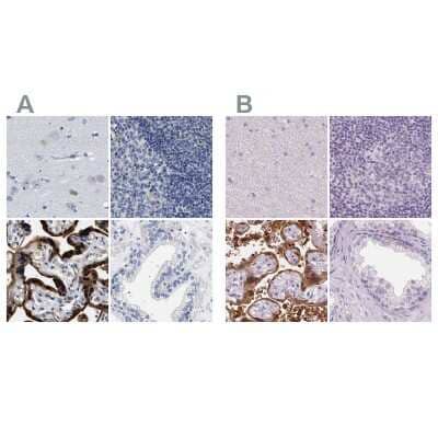 <b>Independent Antibodies Validation. </b>Immunohistochemistry-Paraffin: 17 beta-HSD1/HSD17B1 Antibody [NBP1-84901] - Staining of human cerebral cortex, lymph node, placenta and prostate using Anti-HSD17B1 antibody NBP1-84901 (A) shows similar protein distribution across tissues to independent antibody NBP2-39053 (B).