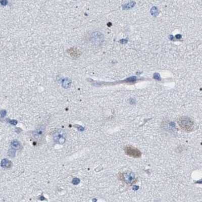 Immunohistochemistry-Paraffin: 17 beta-HSD1/HSD17B1 Antibody [NBP1-84901] - Staining of human cerebral cortex.