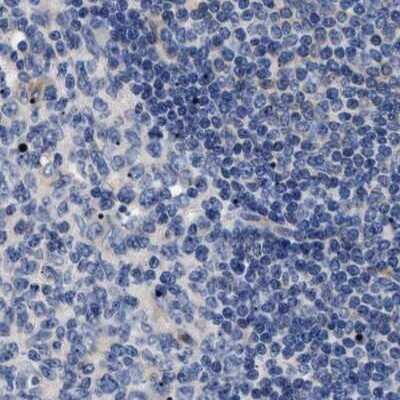 Immunohistochemistry-Paraffin: 17 beta-HSD1/HSD17B1 Antibody [NBP1-84901] - Staining of human lymph node.