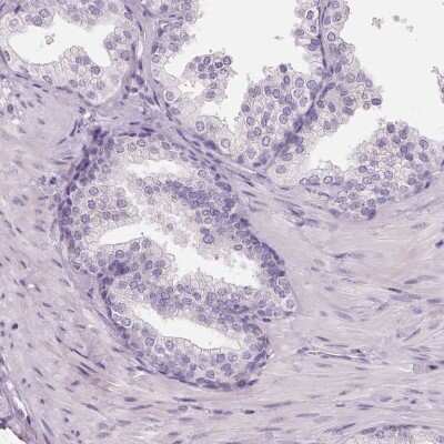 Immunohistochemistry-Paraffin: 17 beta-HSD1/HSD17B1 Antibody [NBP2-39053] - Staining of human prostate shows low expression as expected.