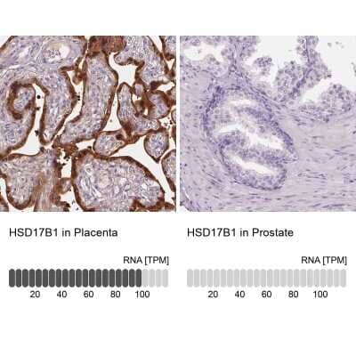 Immunohistochemistry-Paraffin: 17 beta-HSD1/HSD17B1 Antibody [NBP2-39053] - Staining in human placenta and prostate tissues using anti-HSD17B1 antibody. Corresponding HSD17B1 RNA-seq data are presented for the same tissues.