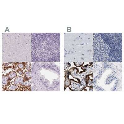 <b>Independent Antibodies Validation and Orthogonal Strategies Validation.</b>Immunohistochemistry-Paraffin: 17 beta-HSD1/HSD17B1 Antibody [NBP2-39053] - Staining of human cerebral cortex, lymph node, placenta and prostate using Anti-HSD17B1 antibody NBP2-39053 (A) shows similar protein distribution across tissues to independent antibody NBP1-84901 (B).