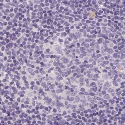 Immunohistochemistry-Paraffin: 17 beta-HSD1/HSD17B1 Antibody [NBP2-39053] - Staining of human lymph node.